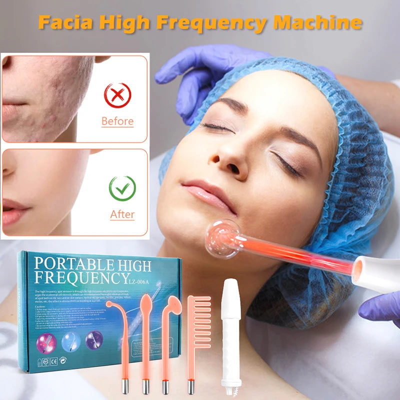 Portable High Frequency Electrotherapy Wand