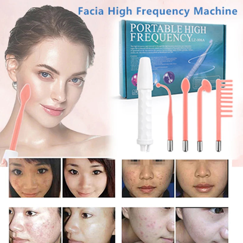 Portable High Frequency Electrotherapy Wand