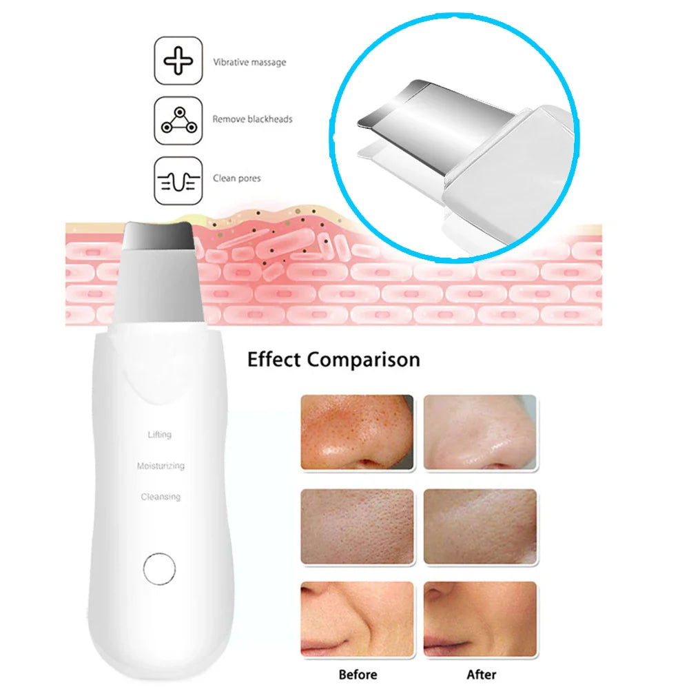 GlowRenew Ultrasonic Pore Wand