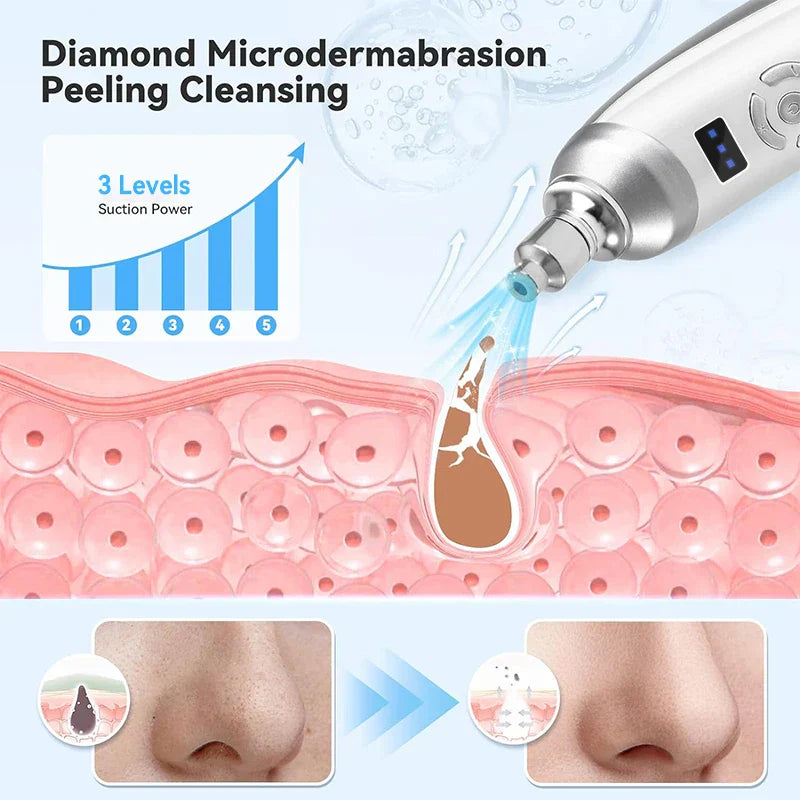 LuxeGlow Diamond Peel Pro